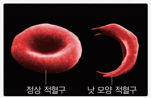 [비상교육] 고등_생명과학Ⅱ_5-3_183p_낫 모양 적혈구 빈혈증 (1)